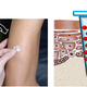 Illustration for article titled This Biotech Discovery Means Youll Never Need a Painful Flu Shot Again
